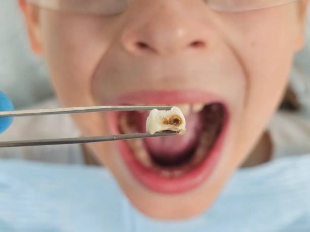 Best Emergency Dentist for Kids  in USA